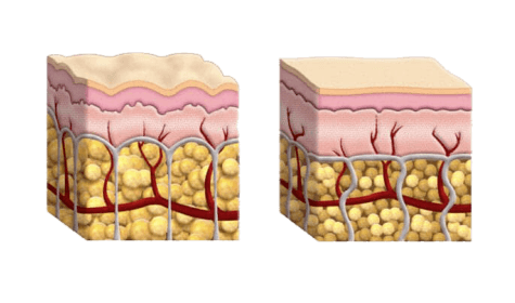 Collagen